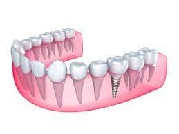 Microsurgery